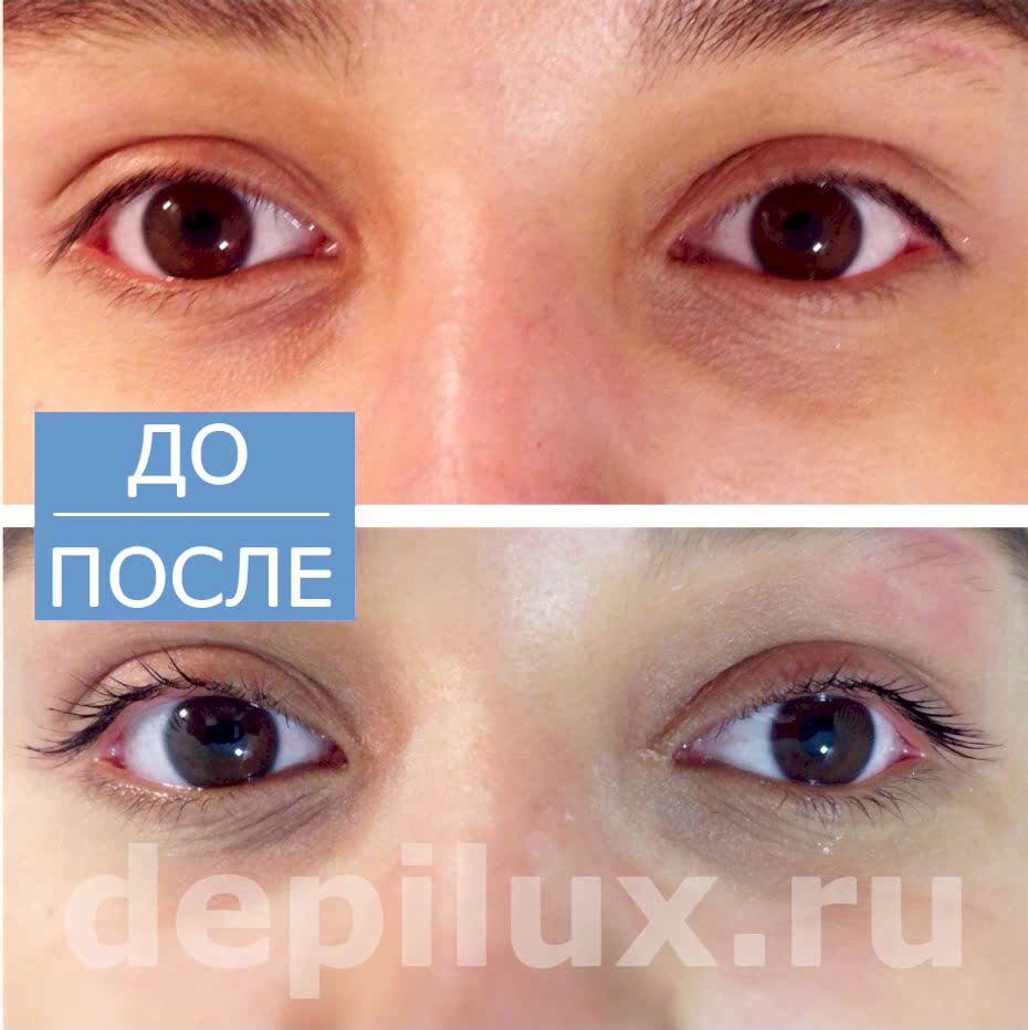 Фото ламинирования ресниц до и после