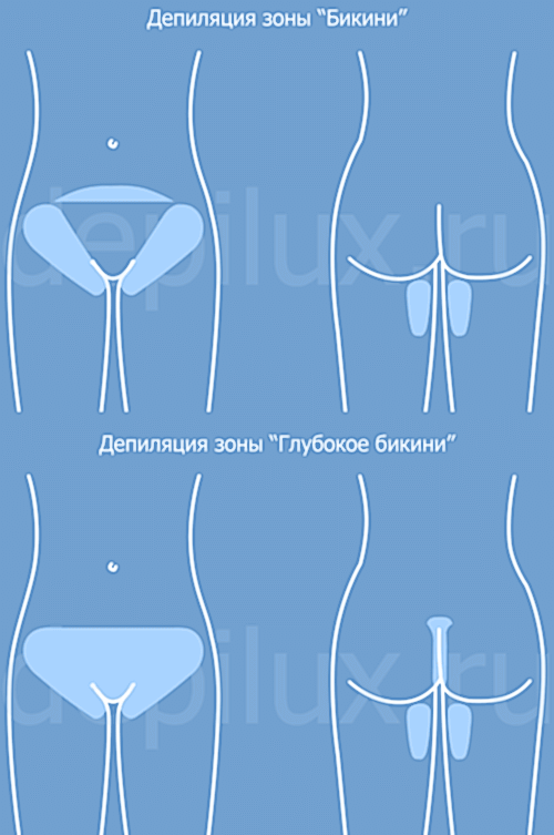 Депиляция бикини. Отличие бикини от глубокого бикини.