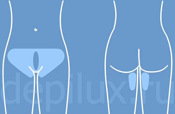 Французское бикини - как это выглядит