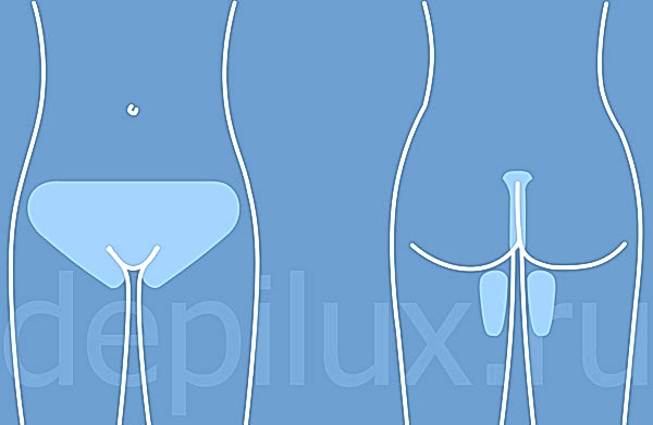 Голливудское бикини, он же Глубокое бикини