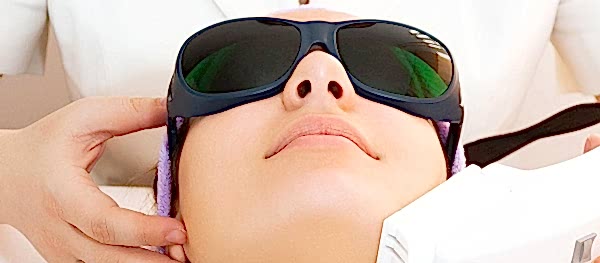 О лазерной эпиляции