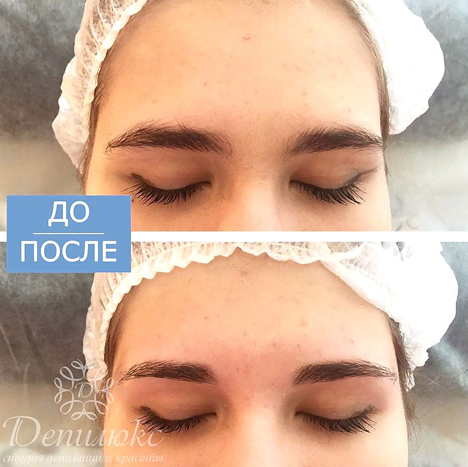 Коррекция бровей - фотография до и после - в салоне Депилюкс